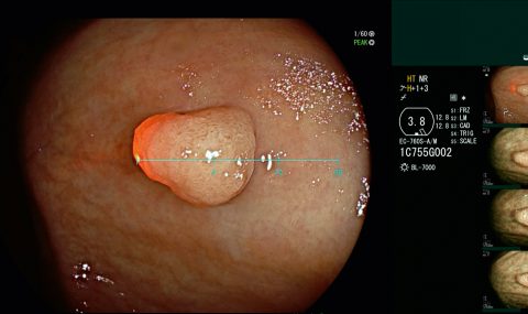 01_Fujifilm_ScaleEye_ClinicalImage